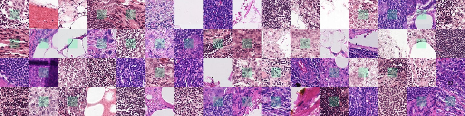 PCam example images. Green boxes indicate positive labels.